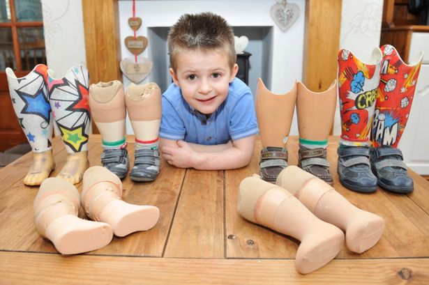 4YO BOY WITH NO LEGS IS FUNDRAISING TO PAY FOR NEW EXTENSION