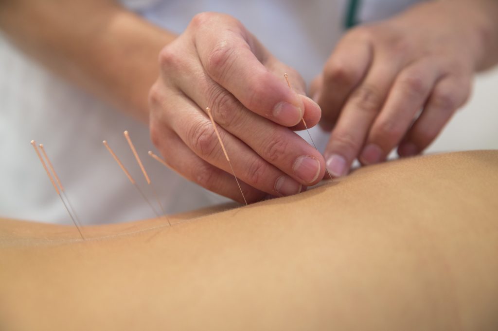 MUM SLAMS ACUPUNCTURE CLINIC AS CRUEL FOR OFFERING TO 'CURE' AUTISM