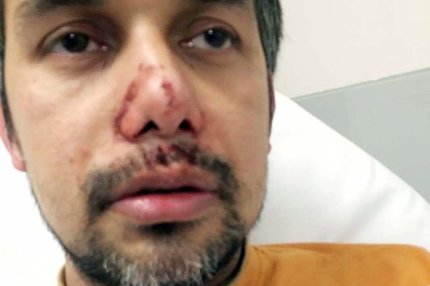 TAKEAWAY OWNER BATTERED SENSELESS BY THUGS OVER £6.50 CHICKEN DINNER