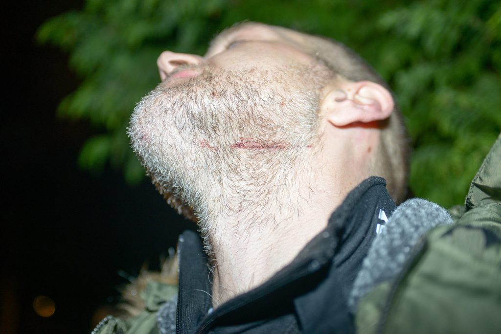 DOCTOR RELIVES THE MOMENT HE HELPED TUBE SLASH VICTIM