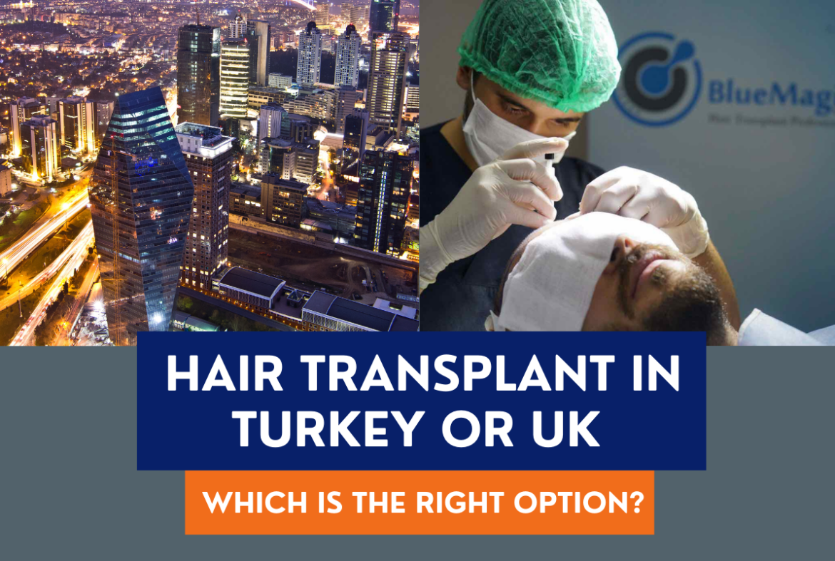 Hair Transplant in Turkey or UK – Which is the Right Option?