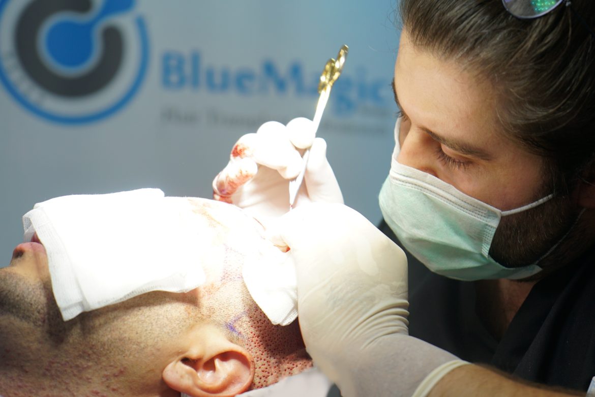 Why Turkey is Among the Top Countries to Visit for a Hair Transplant?